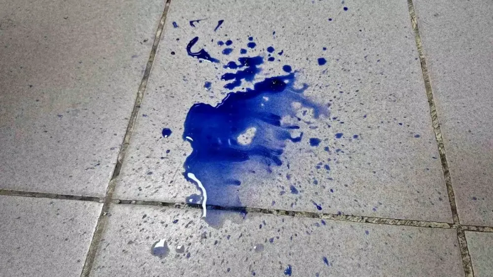 Pamuk şekeri zehirlemeye neden oldu